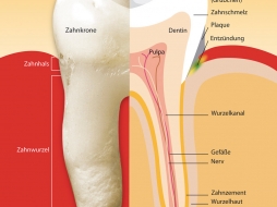 Parodontitis / Parodontose Behandlung in Fürth durch Zahnarzt Aalai